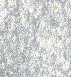 A-204 [A204]人橫紋肌肉瘤細(xì)胞主圖