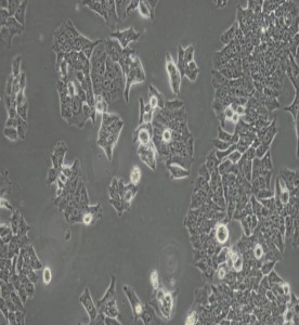 BIU-87人膀胱癌細(xì)胞主圖