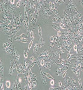 C643人甲狀腺癌細(xì)胞主圖