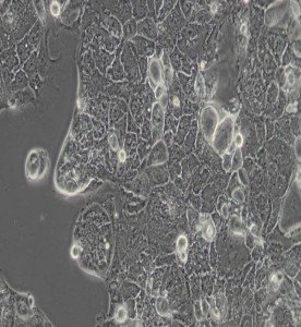 Caco-2人結直腸腺癌細胞主圖