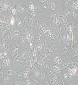Caki-1人腎透明細胞癌皮膚轉移細胞主圖