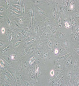 Daoy人髓母細(xì)胞瘤細(xì)胞主圖