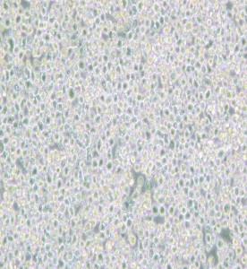 PC 61 5.3 [PC 61; PC 61.5.3]雜交瘤細胞CD25主圖