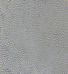 P815小鼠肥大細(xì)胞瘤細(xì)胞主圖