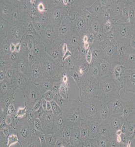 MARC-145非洲綠猴胚胎腎細胞主圖