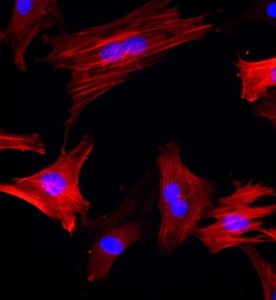 大鼠大隱靜脈平滑肌細胞主圖