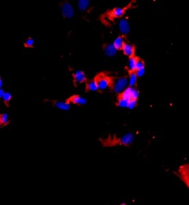 人肺大動脈內皮細胞主圖