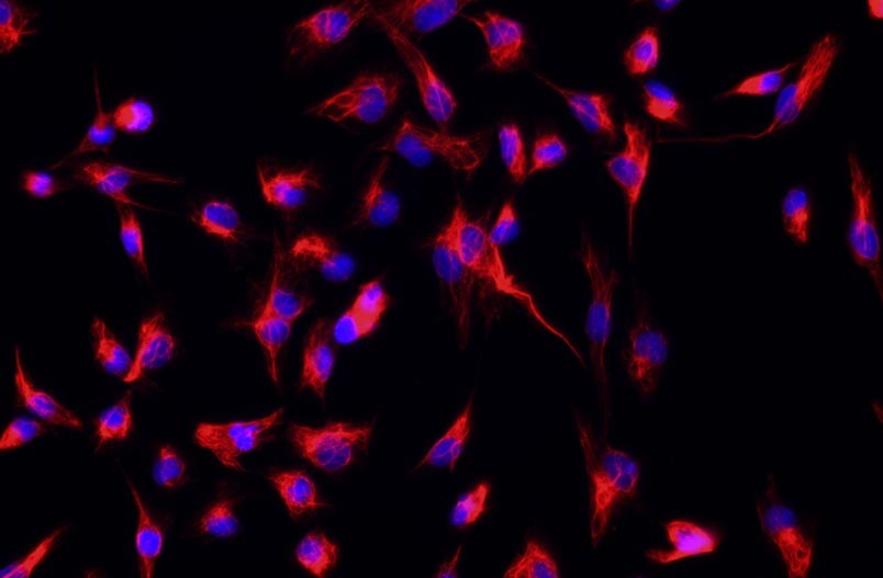 小鼠腎成纖維細胞主圖
