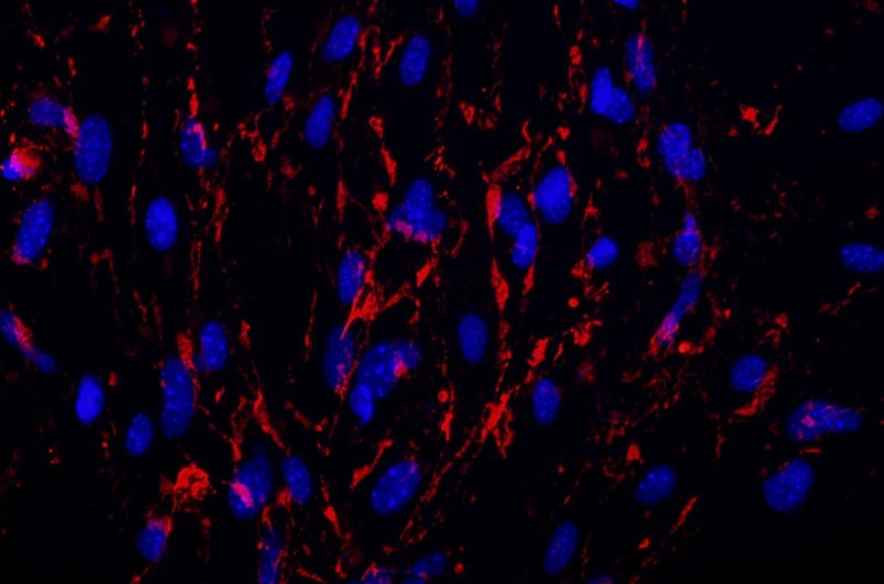 小鼠腦微血管內(nèi)皮細胞主圖