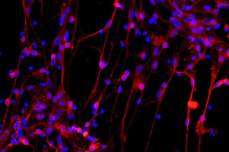 小鼠皮層神經元細胞主圖