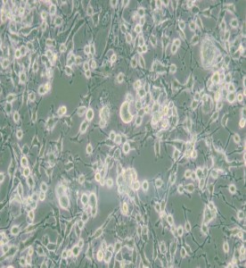 MDA-MB-436人乳腺癌細胞(DMEM)主圖